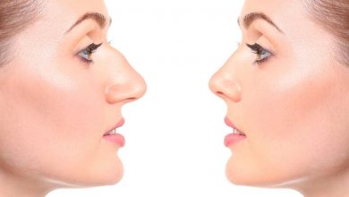Photo of Important Aspects to Consider When Looking to Have Rhinoplasty Surgery