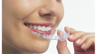 Photo of Invisalign for Teens: Their Use, Pros and Cons
