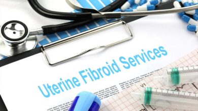 Photo of All you need to know about uterine fibroids