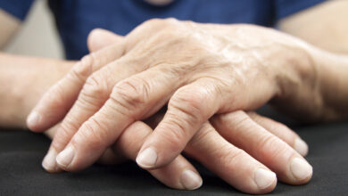 Photo of Why should you get treated for arthritis in Tampa?