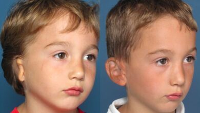 Photo of Medical Breakthrough Offers Relief For Microtia Patients